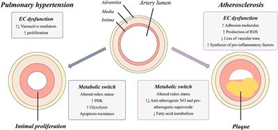 Metabolic Alterations in Cardiopulmonary Vascular Dysfunction